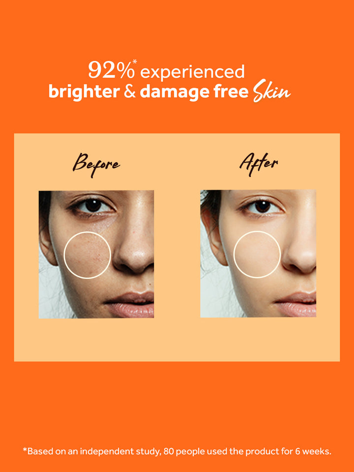 atulya Vitamin C Facial Mist Toner | Tightens Open Pores - 150ml