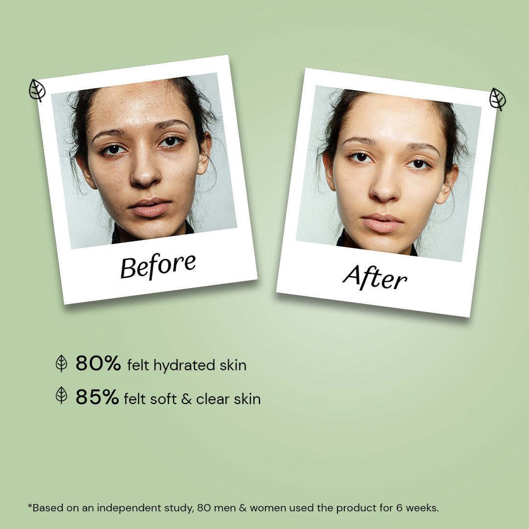 Atulya Aloe Vera Gel | Anti-acne| Moisturizing - 200gm