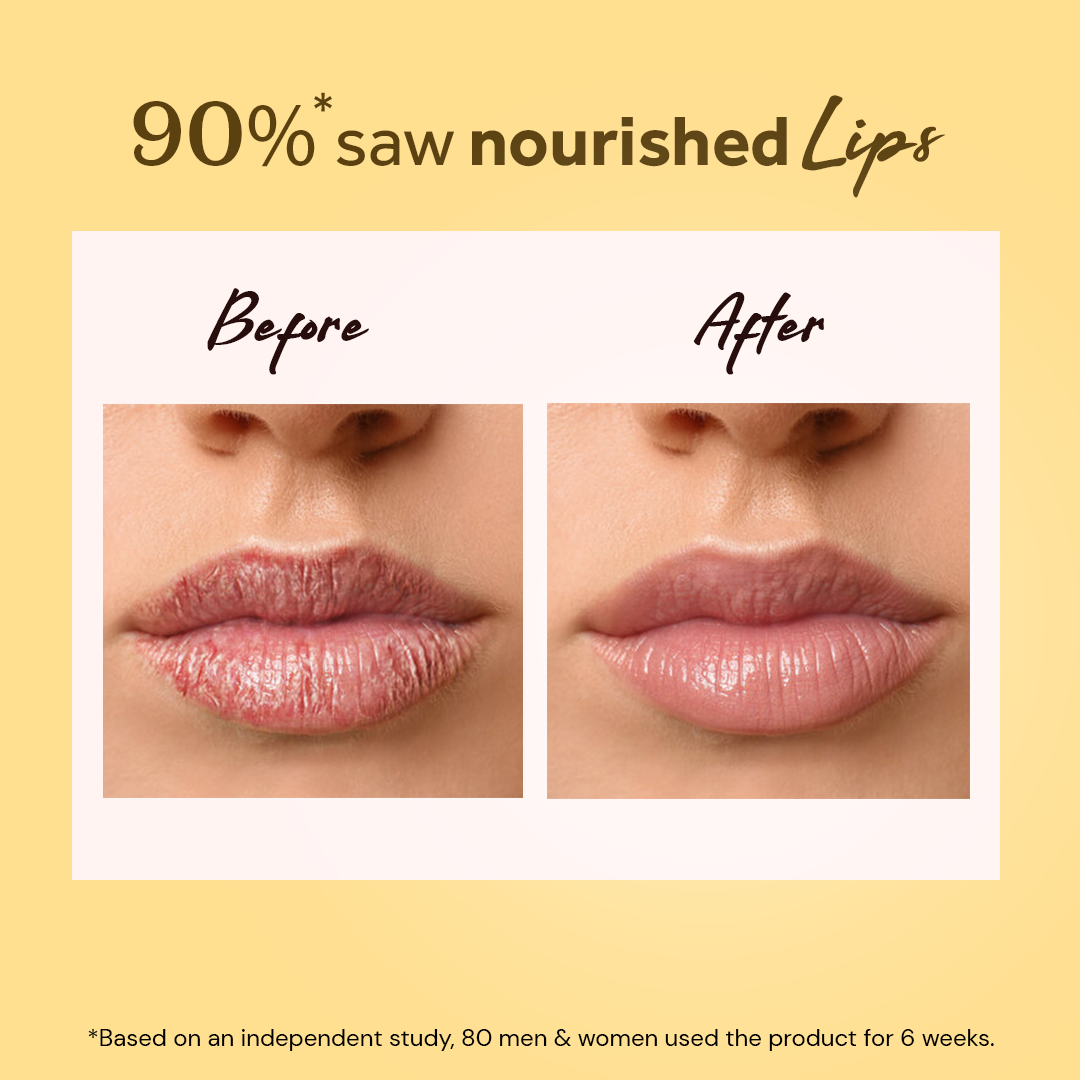 atulya Honey Lip Balm for Hydrating Lips - 5gm