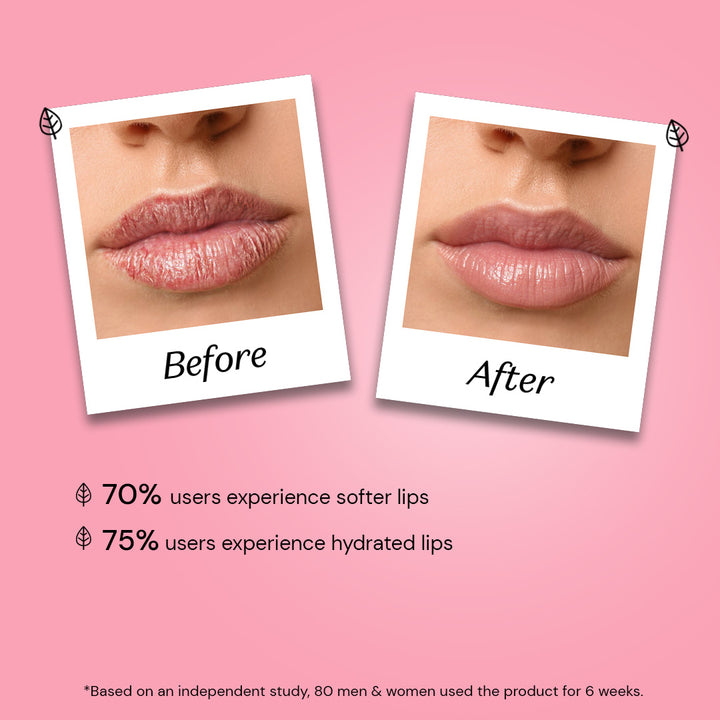 Atulya Rose Natural Lip Balm| Softening and Nourishing - 5gm