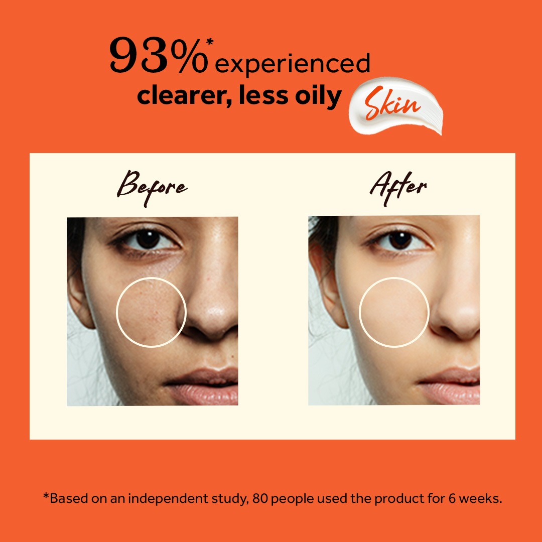 Atulya Vitamin C Face Mask | Brightens and Hydrates Skin - 200gm