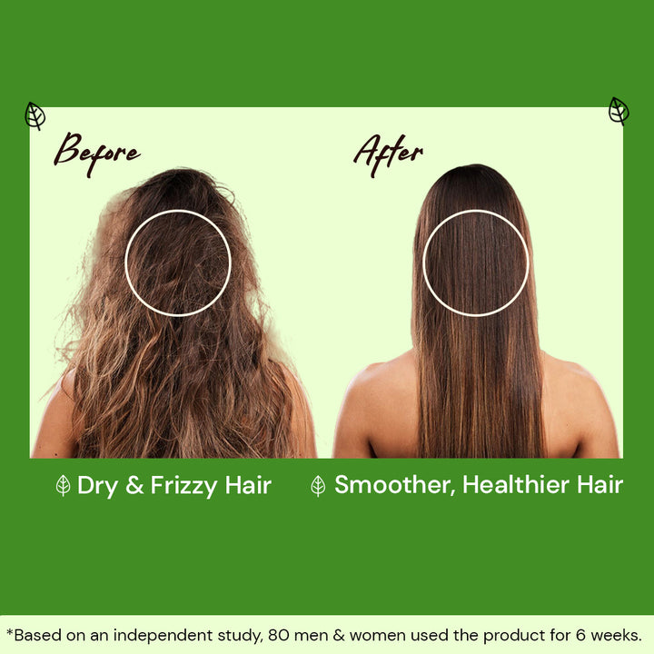 Atulya Neem Pure Cold Pressed Oil | Anti-bacterial - 200ml