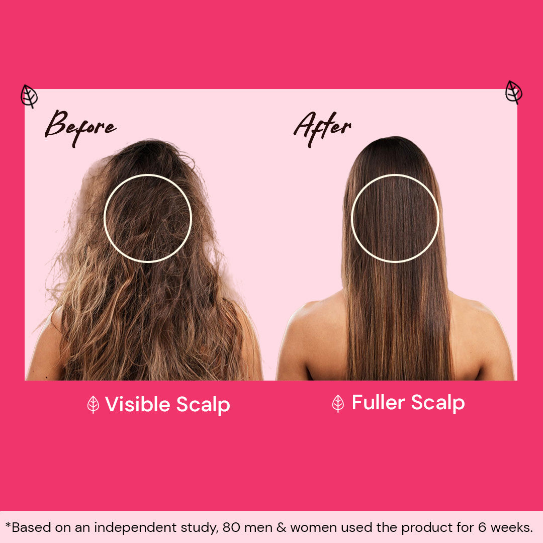 Atulya Onion & Bhringraj Hair Shampoo | Anti-dandruff Shampoo - 300ml