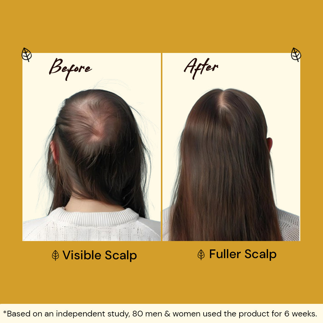 Atulya Keratin & Wheat protein Shampoo + Conditioner Set (Pack of 2) - 300ml Each