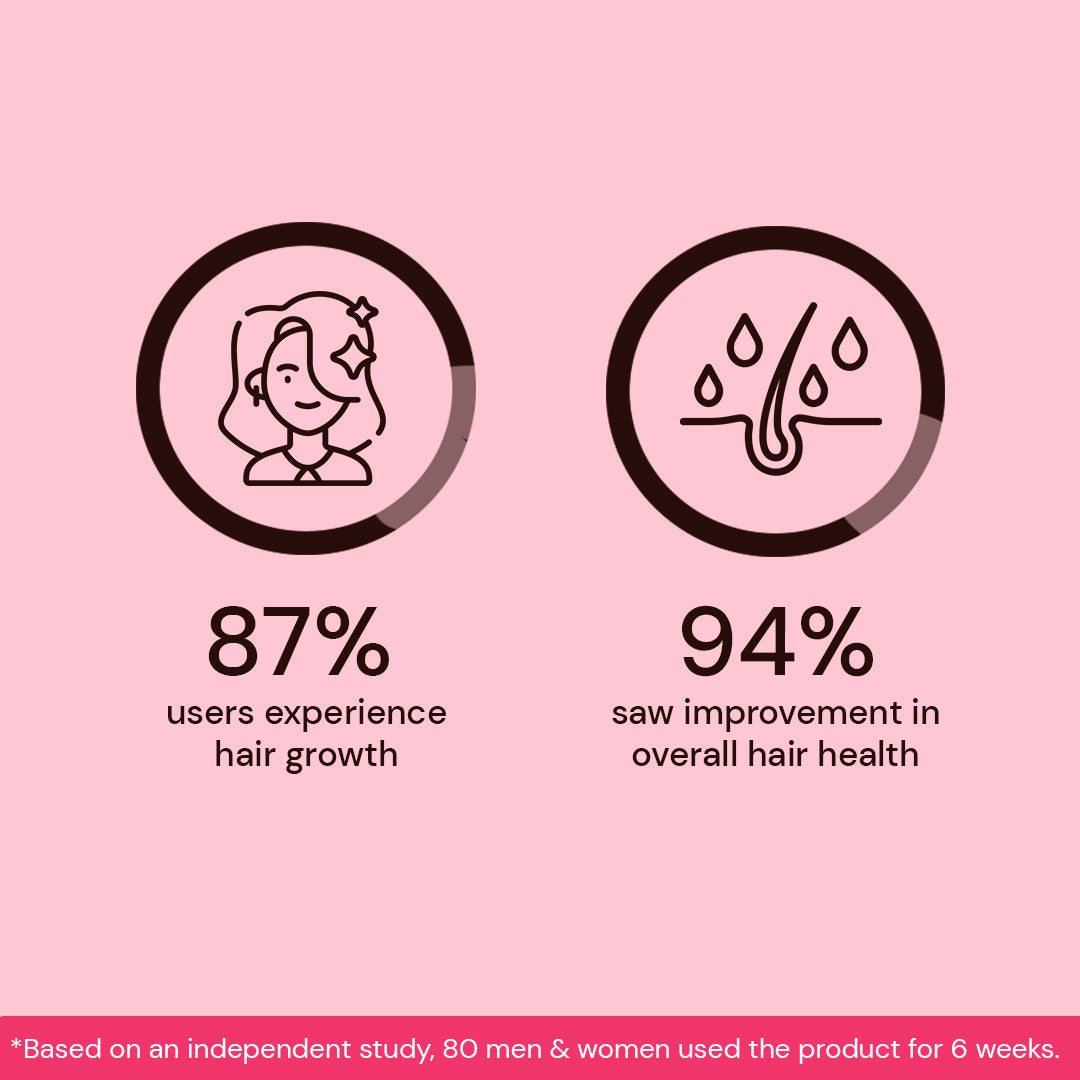 Atulya Onion & Bhringraj Hair Shampoo | Anti-dandruff Shampoo - 300ml