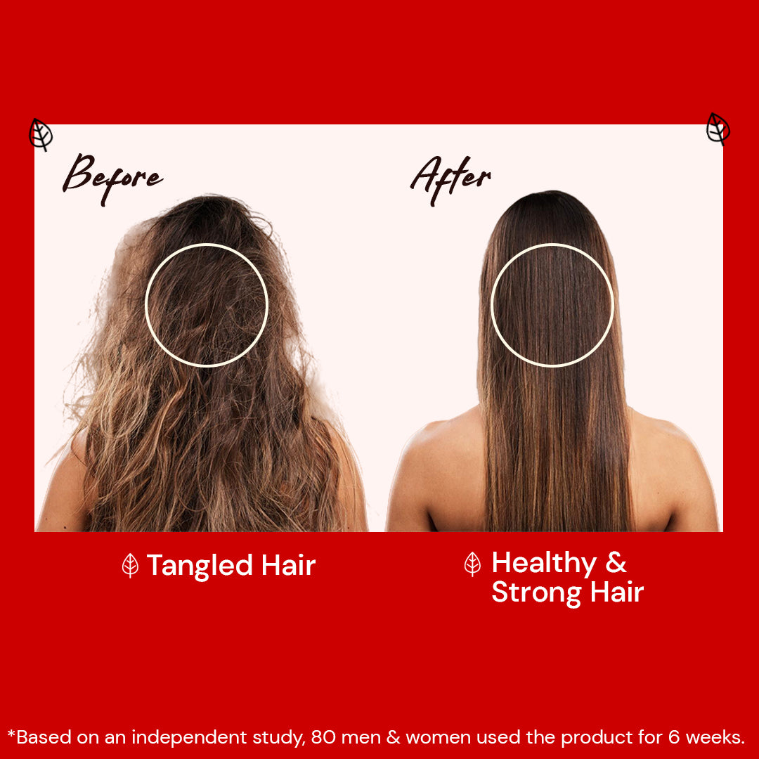 Atulya Hibiscus & Black Seed Hair Conditioner |Hair Softener - 300ml