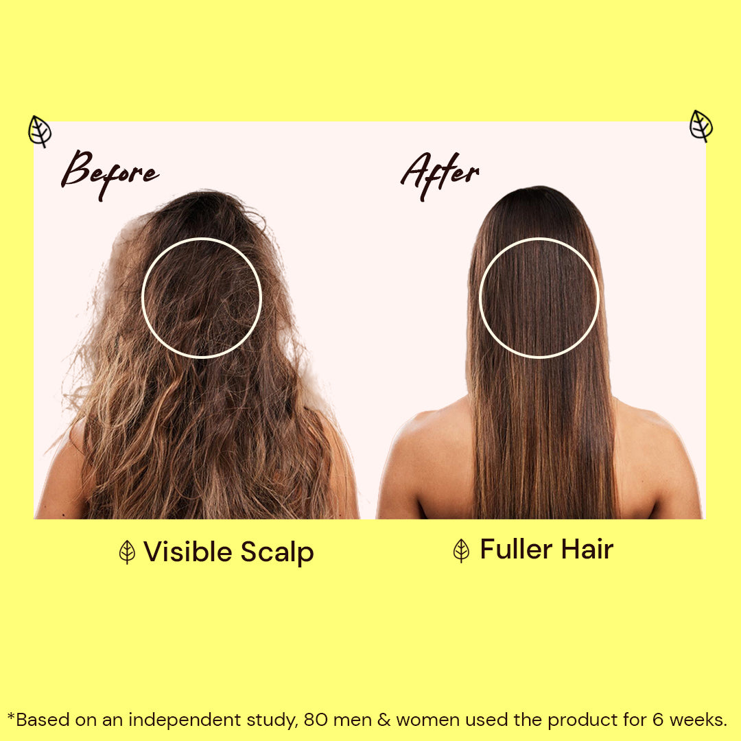 Atulya Amla & Bhringraj Shampoo Combo - 300ml Each (Pack of 2)