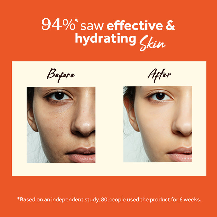 Atulya Vitamin C Face Serum | Brightening and Hydrating -  30ml