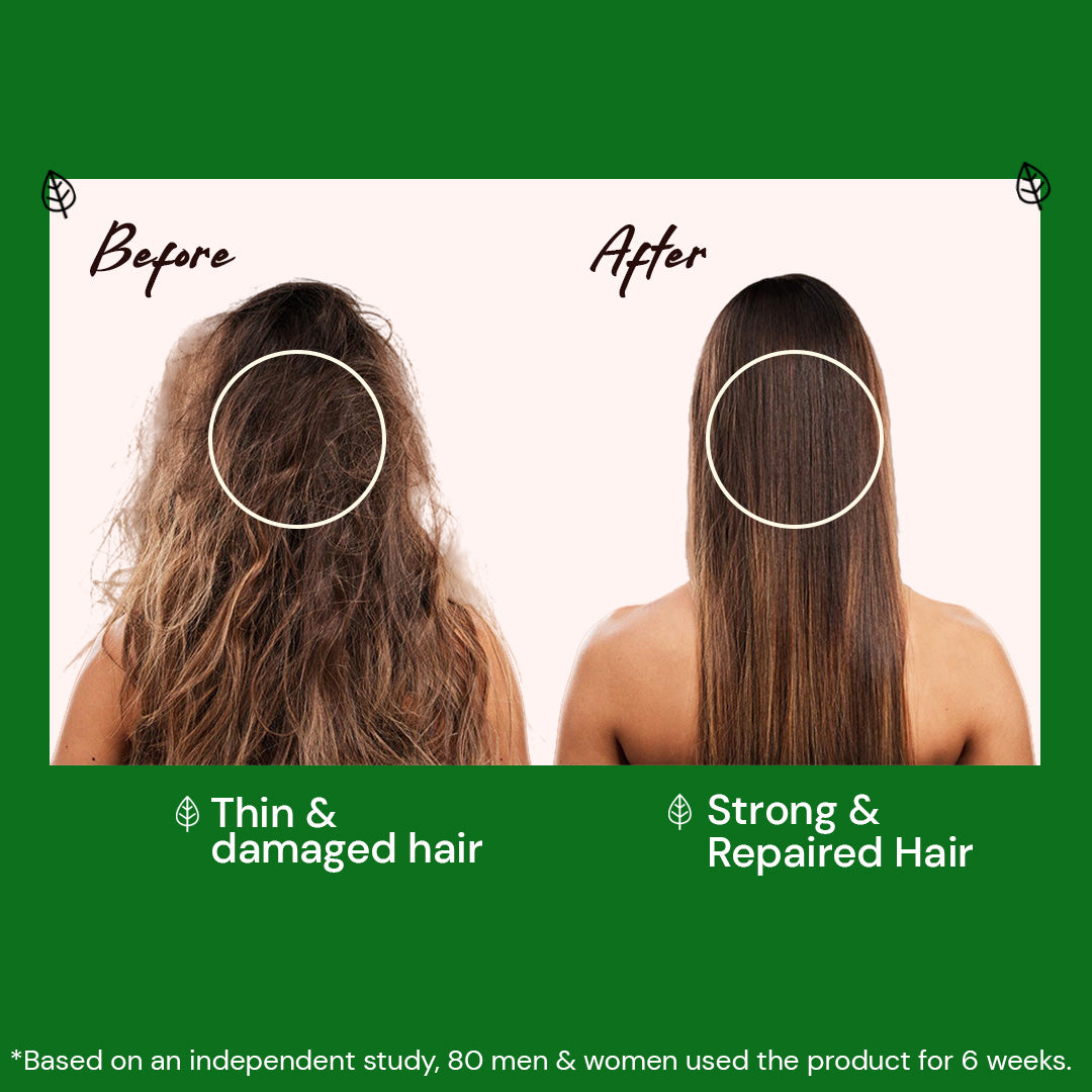 Atulya Neem & Sage Shampoo | Anti-dandruff and Anti-fungal - 300ml