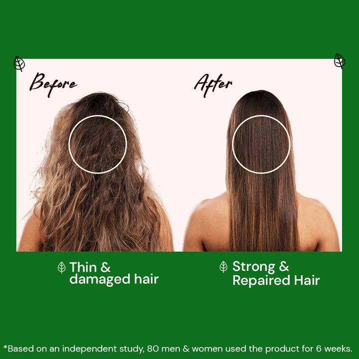 Atulya Neem & Sage Shampoo | Anti-dandruff and Anti-fungal - 300ml