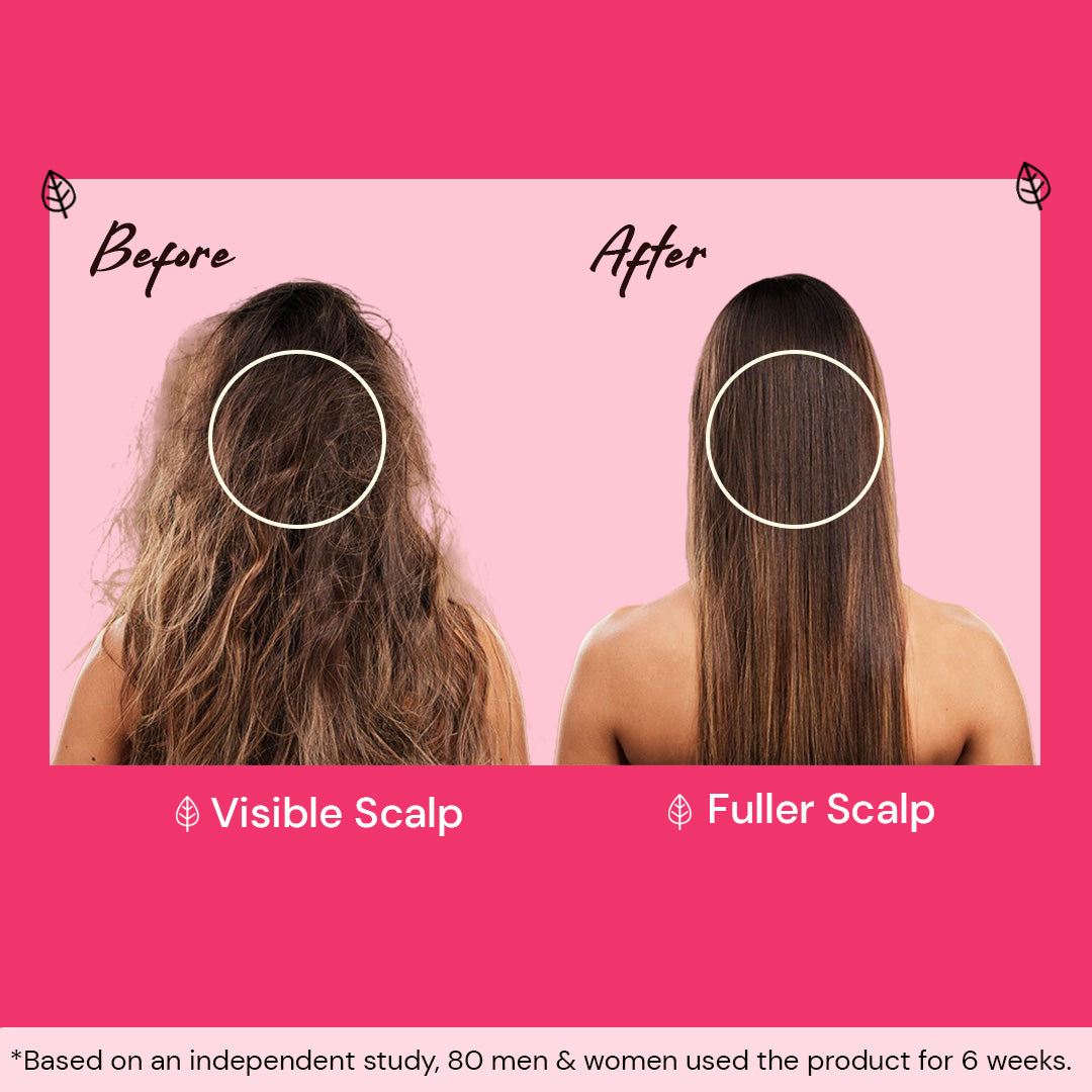 Atulya Onion & Bhringraj Hair Conditioner | Hair Smoothener - 300ml