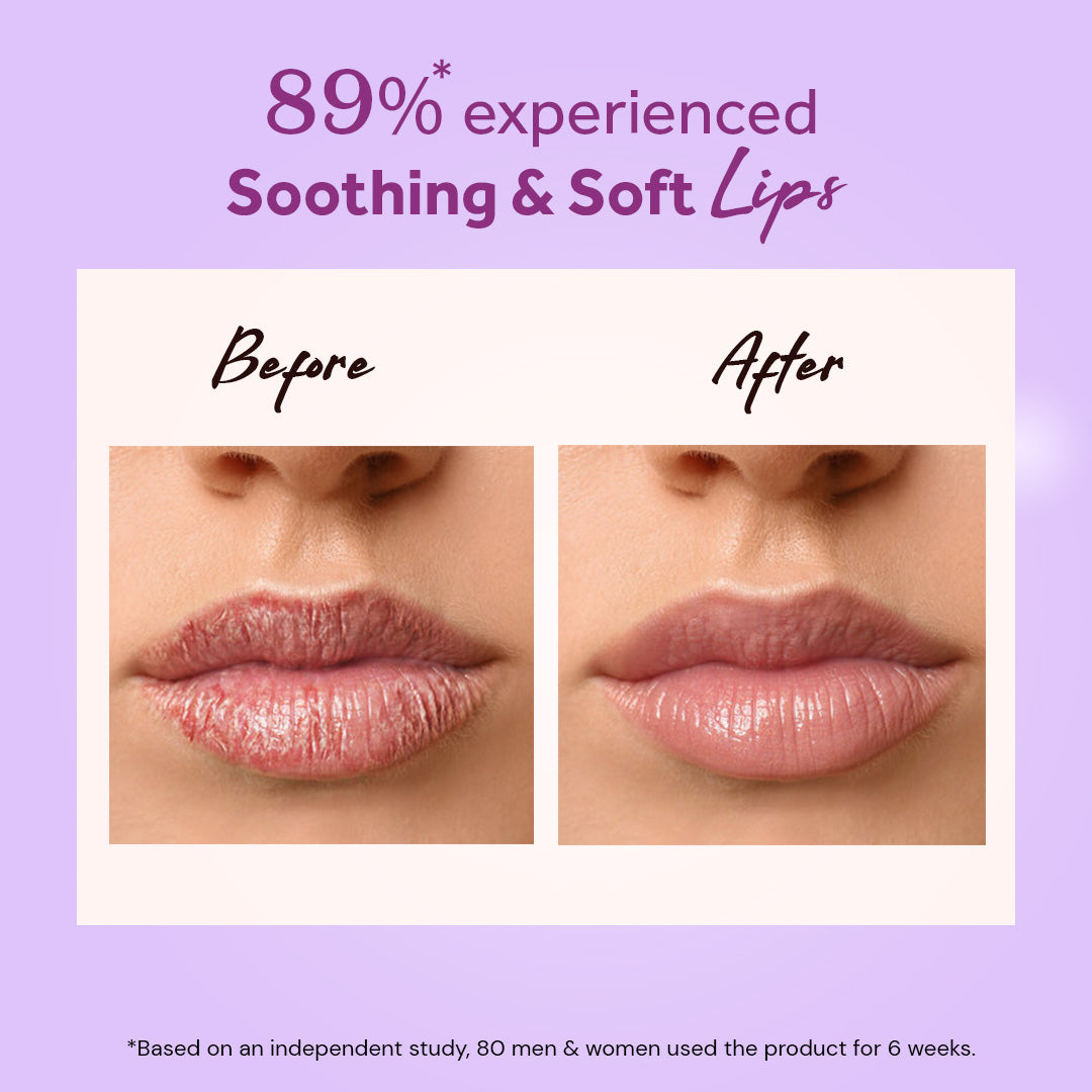 Atulya Wine Grape Fruit Natural Lip Balm | For Nourishing Lips - 5gm