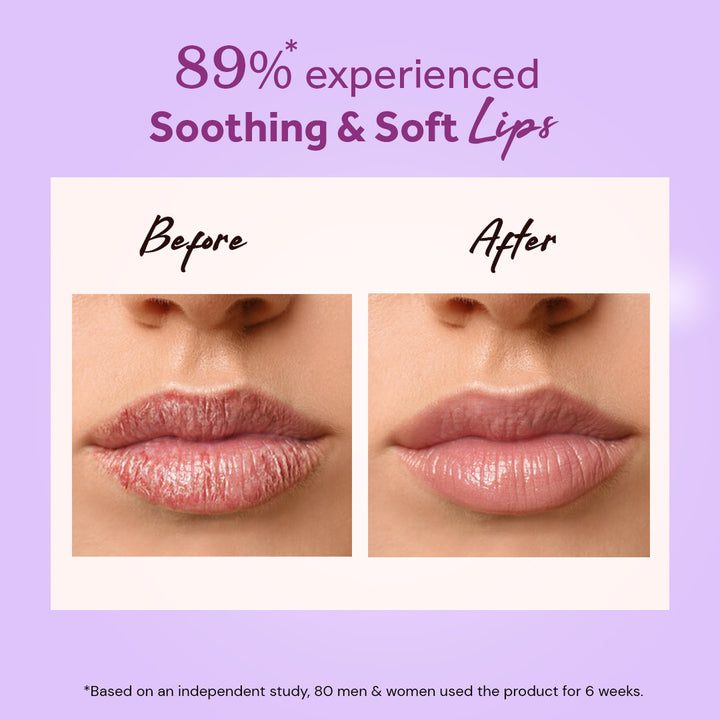 Atulya Wine Grape Fruit Natural Lip Balm | For Nourishing Lips - 5gm