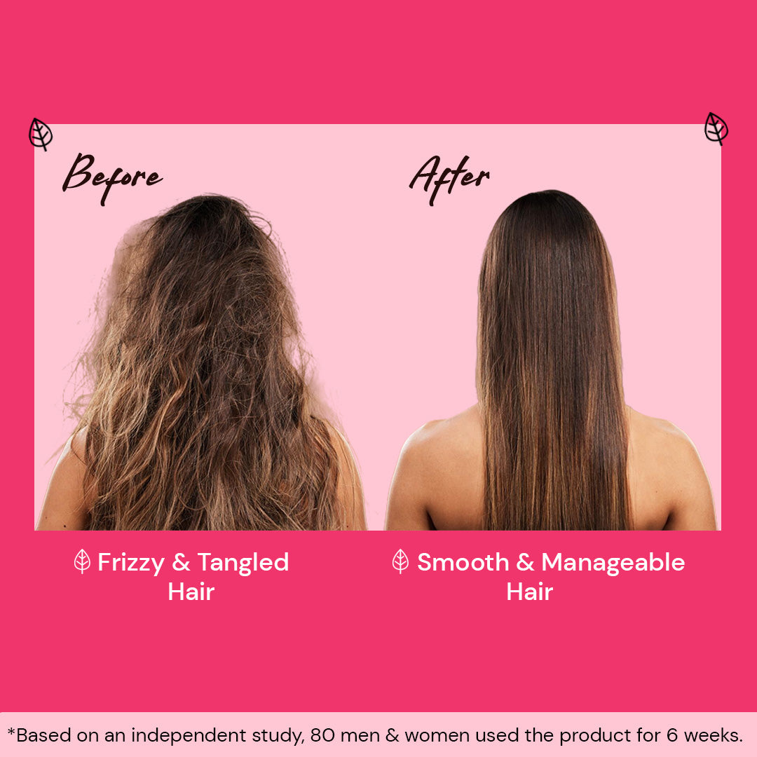 Atulya Onion & Bhringraj Hair Serum for Natural Hair Growth - 50ml