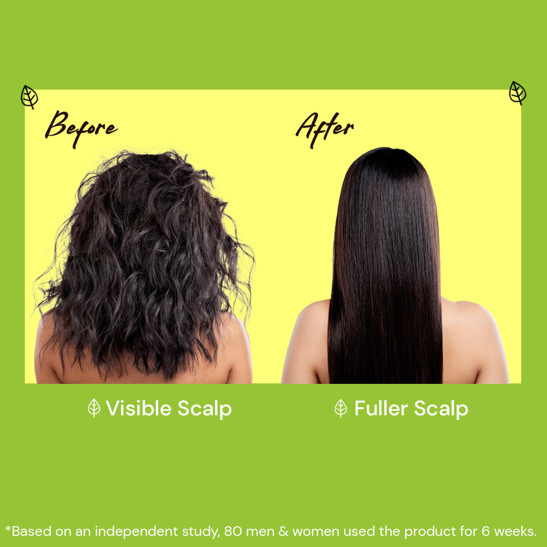 Atulya Amla & Bhringraj Hair Oil | Strengthening and Anti-greying - 200ml