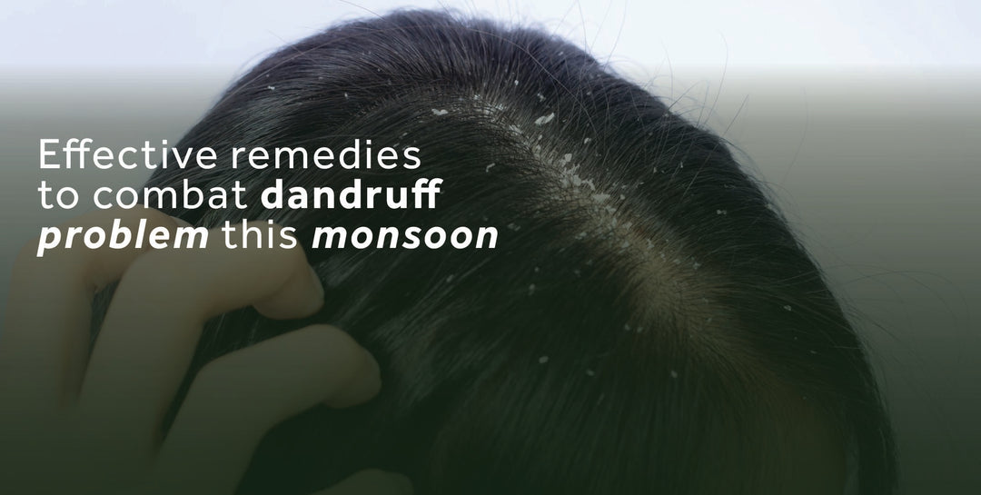 Effective remedies to combat dandruff problem this monsoon
