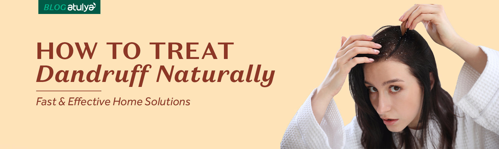 How to Treat Dandruff Naturally: Fast & Effective Home Solutions