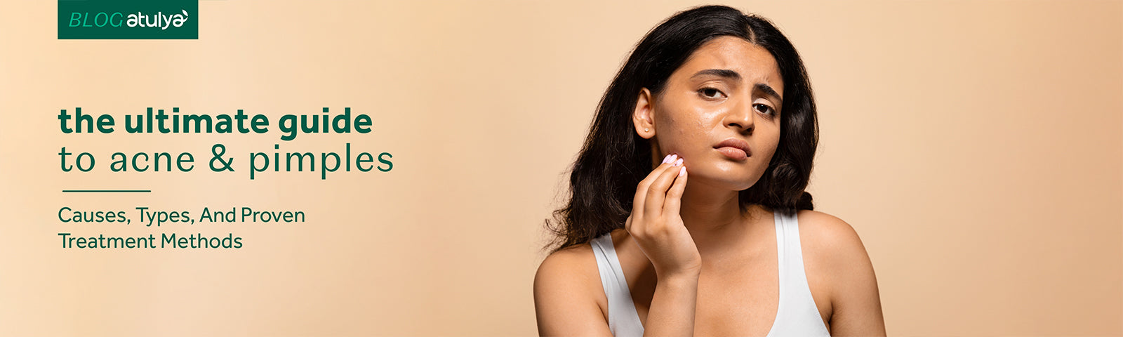 The Ultimate Guide to Acne & Pimples: Causes, Types, and Proven Treatment Methods