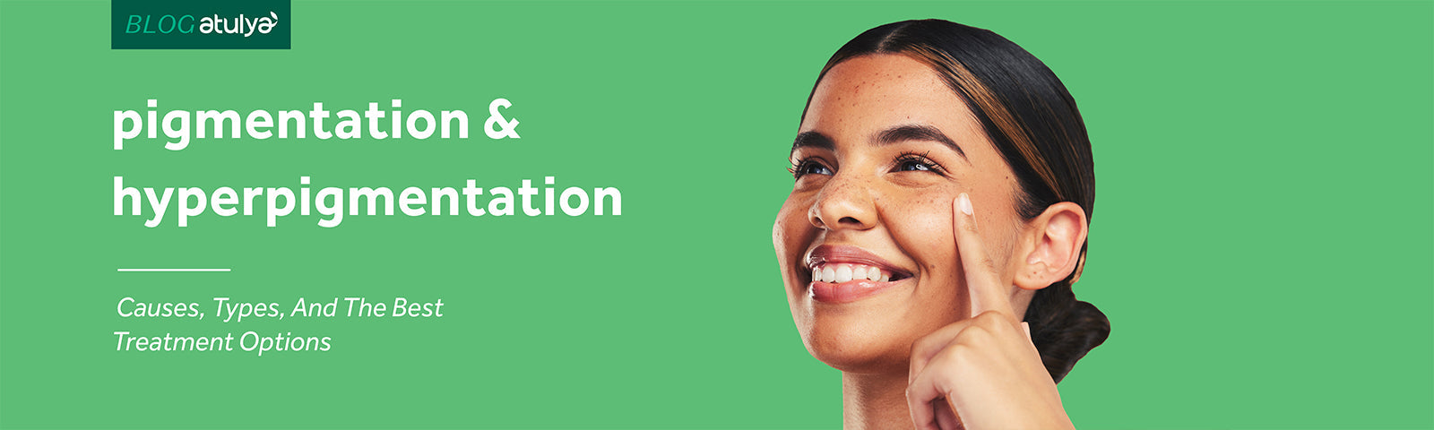 Pigmentation & Hyperpigmentation: Causes, Types, and the Best Treatment Options