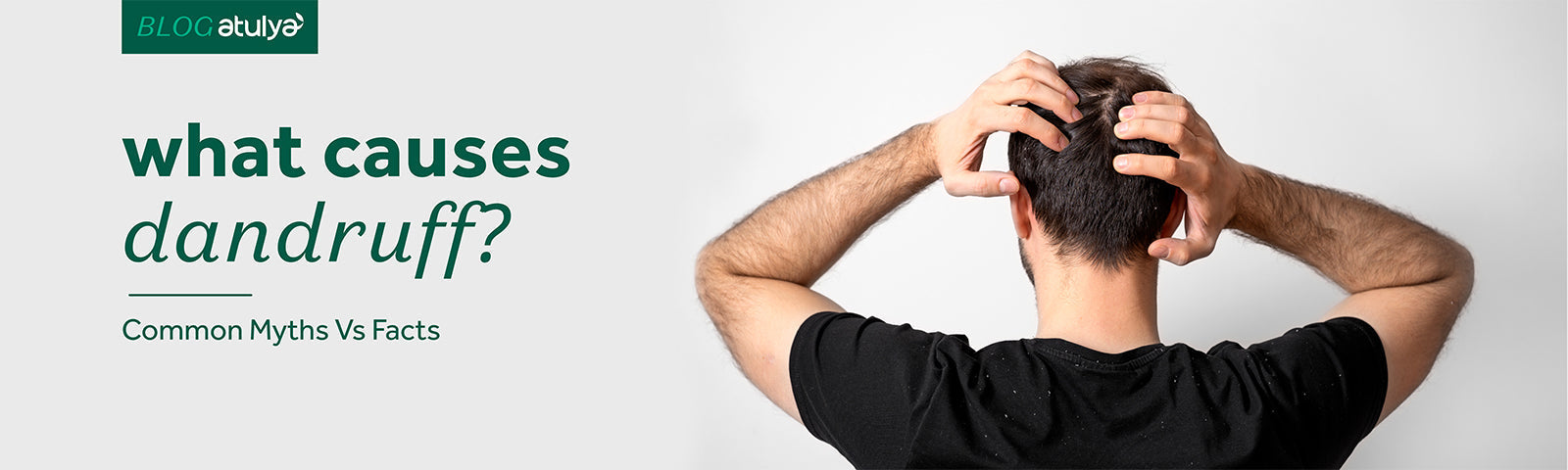 What Causes Dandruff? Common Myths vs. Facts