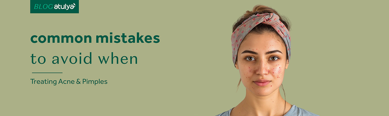 Common Mistakes to Avoid When Treating Acne & Pimples