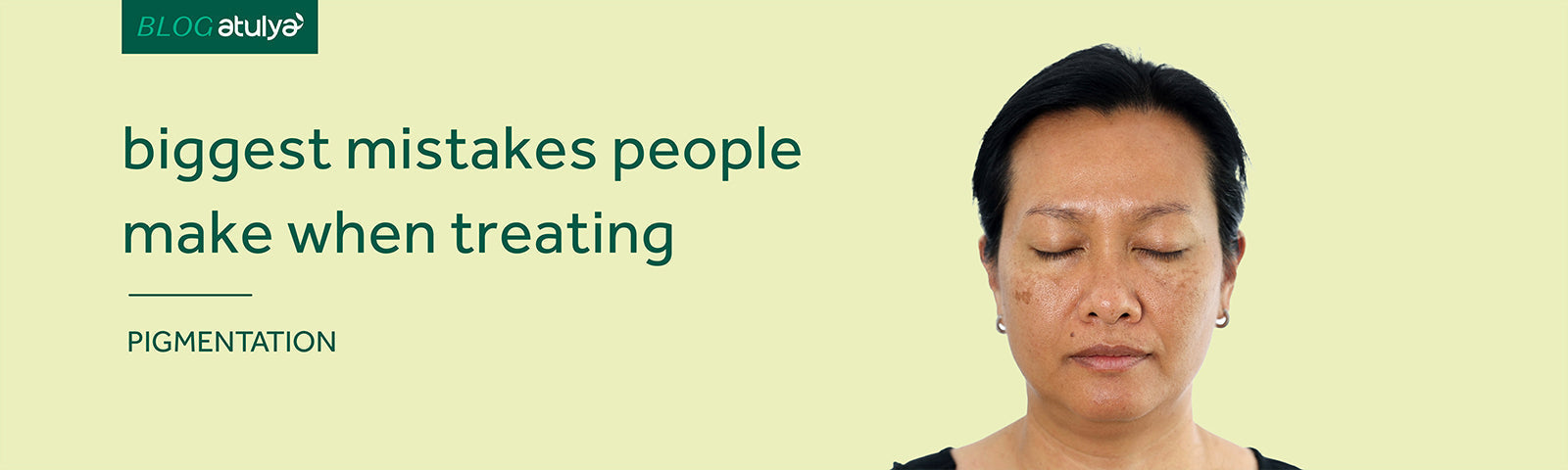Biggest Mistakes People Make When Treating Pigmentation