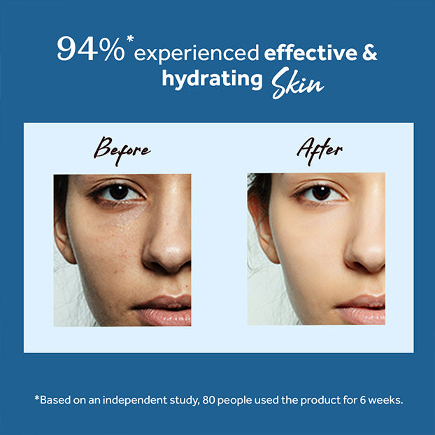 Atulya Tea Tree & Neem Foaming Face Wash and Hyaluronic Acid Face Serum Combo for Clear Hydrated Skin