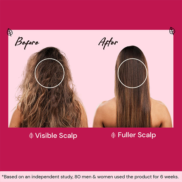 Atulya Onion & Bhringraj Shampoo and Conditioner Combo for Strong Smooth Healthy Hair