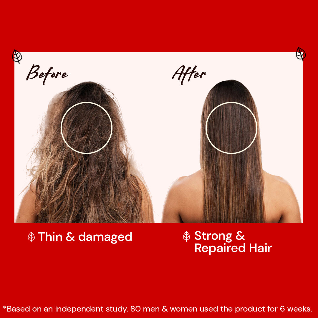 Atulya Hibiscus & Black Seed Hair Care Combo (Set of 4)