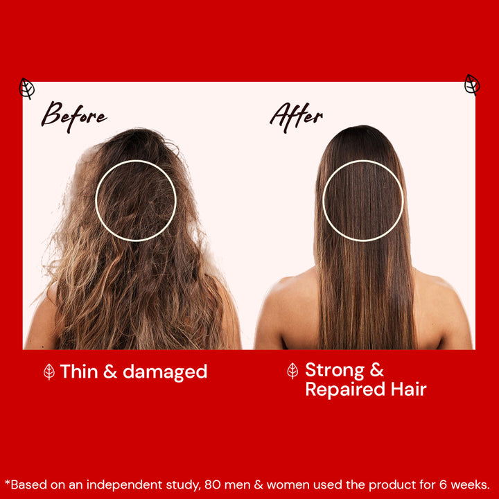 Atulya Hibiscus & Black Seed Hair Care Combo (Set of 4)